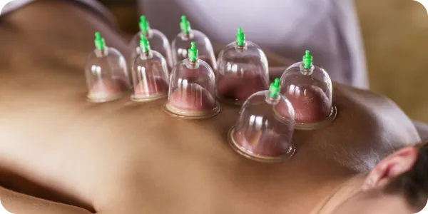 Manual therapy with cupping