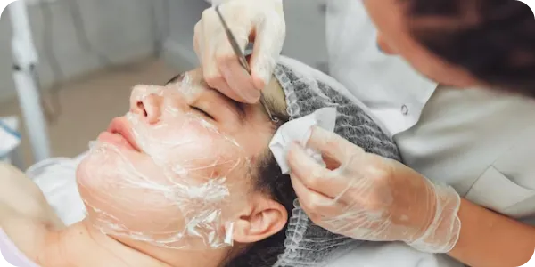 Acne facial